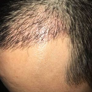 发际线分享社区