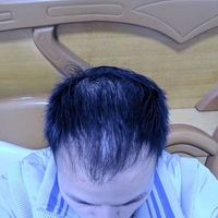 發(fā)際線用戶圖片
