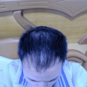 发际线分享社区