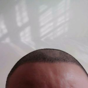 发际线分享社区