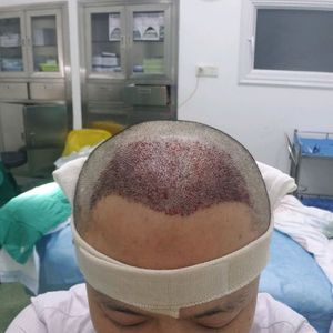 发际线分享社区