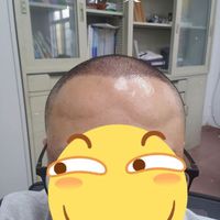 發(fā)際線用戶圖片