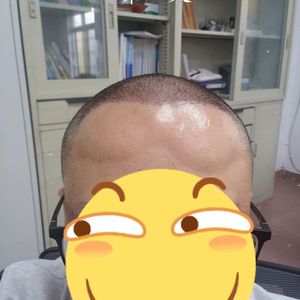 发际线分享社区
