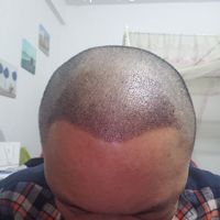 發(fā)際線用戶圖片