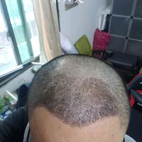 發(fā)際線用戶圖片