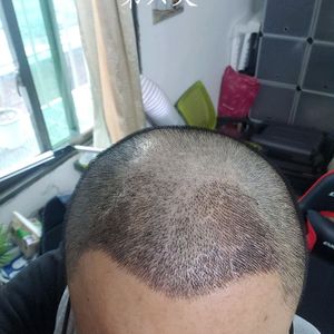 发际线分享社区