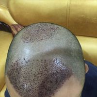 禿頂用戶圖片