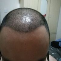 發(fā)際線用戶圖片