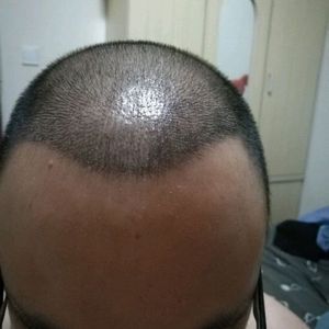 发际线分享社区