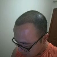 發(fā)際線用戶圖片