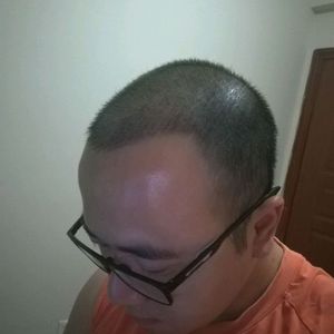 发际线分享社区