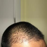 發(fā)際線用戶圖片