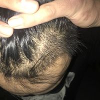 發(fā)際線用戶圖片