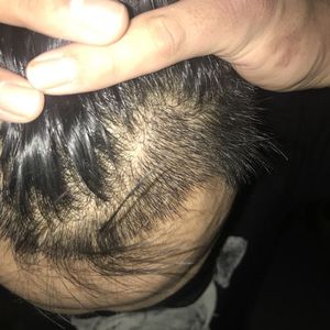 发际线分享社区