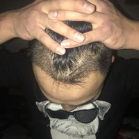 發(fā)際線用戶圖片