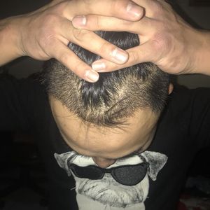 发际线分享社区