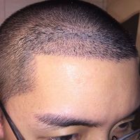 發(fā)際線用戶圖片