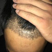 發(fā)際線用戶圖片