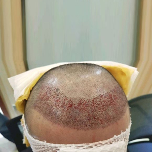 发际线分享社区