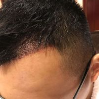 發(fā)際線用戶圖片