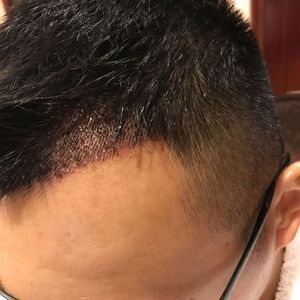 发际线分享社区