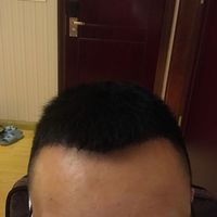 發(fā)際線用戶圖片
