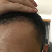 發(fā)際線用戶圖片