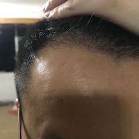 發(fā)際線用戶圖片