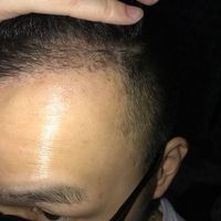 發(fā)際線用戶圖片