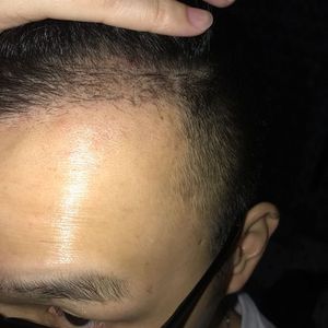 发际线分享社区
