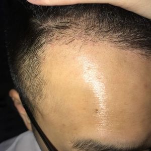 发际线分享社区