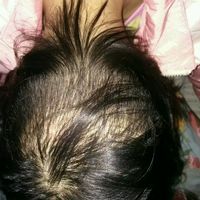 發(fā)際線用戶圖片
