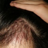 發(fā)際線用戶圖片