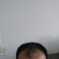 發(fā)際線用戶圖片