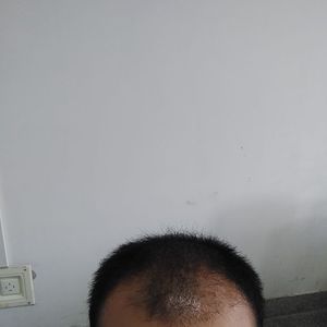 发际线分享社区