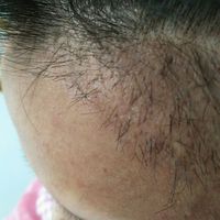 發(fā)際線用戶圖片