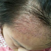 發(fā)際線用戶圖片