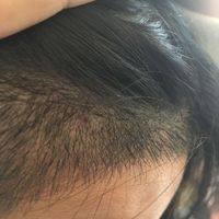 發(fā)際線用戶圖片