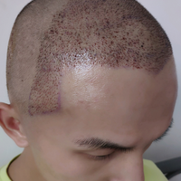發(fā)際線用戶圖片