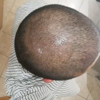 發(fā)際線用戶圖片
