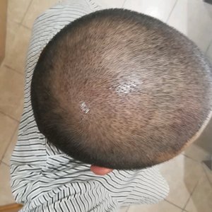 发际线分享社区