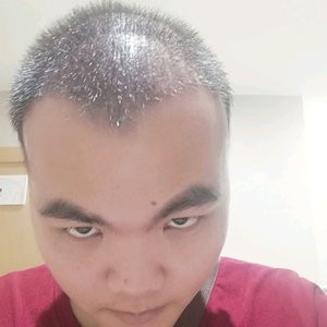 发际线分享社区