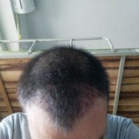 發(fā)際線用戶圖片