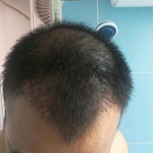 发际线分享社区
