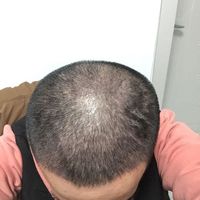 發(fā)際線用戶圖片