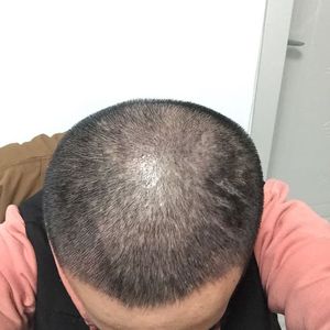 发际线分享社区