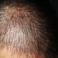 發(fā)際線用戶圖片
