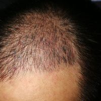 發(fā)際線用戶圖片