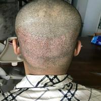 發(fā)際線用戶圖片