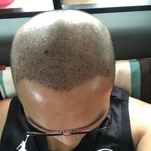 发际线分享社区